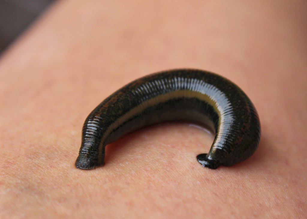 Why were leeches used in ancient times?